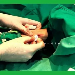 Artículos acceso vascular elenfermerodelpendiente