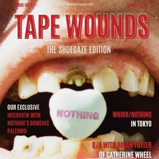 Tape Wounds (про шугейз и не только)