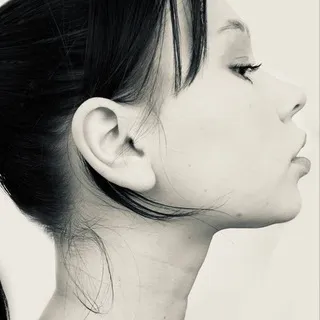 eMiU